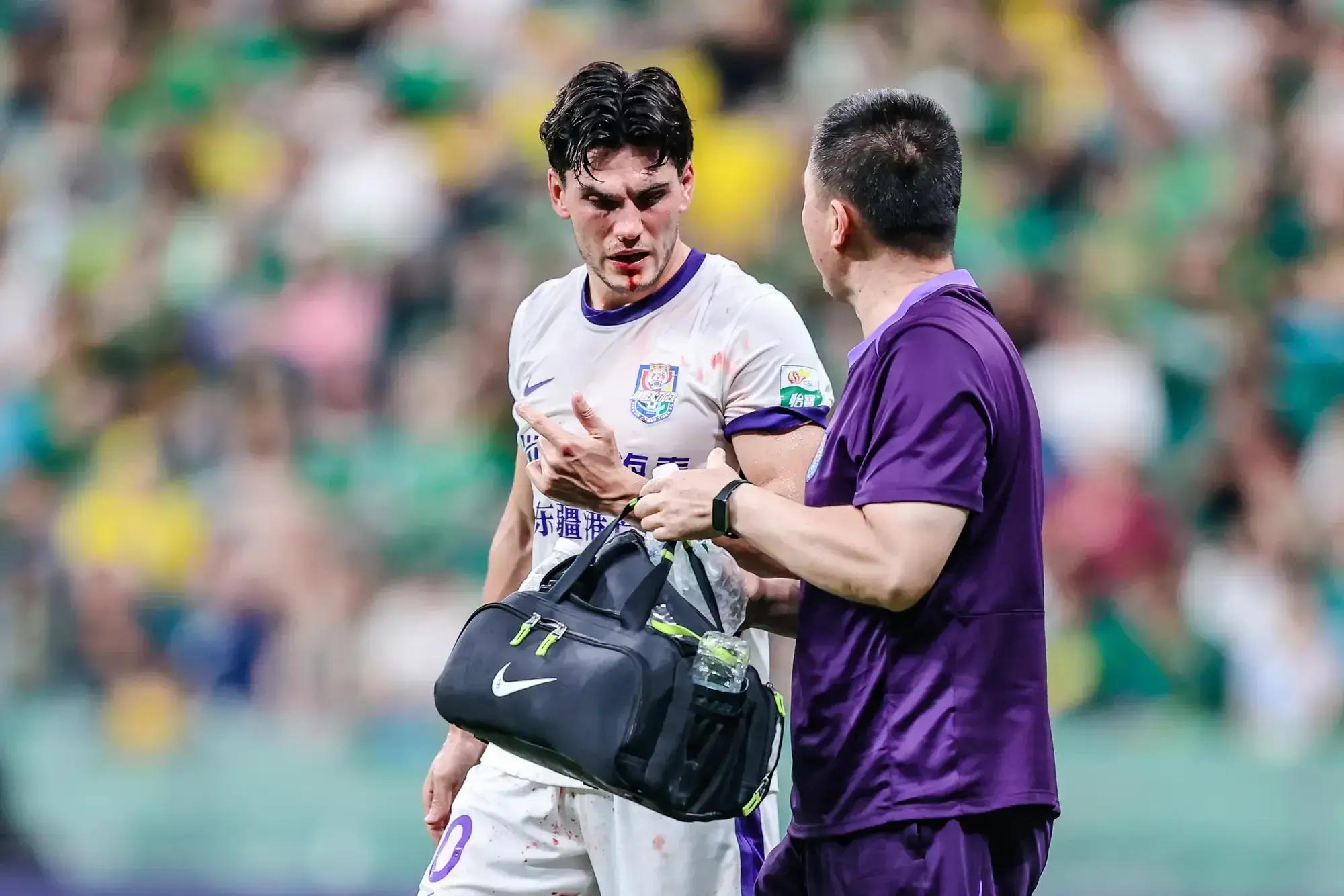 失误成本昂贵门将遭遇球迷抨击(门将 失误)